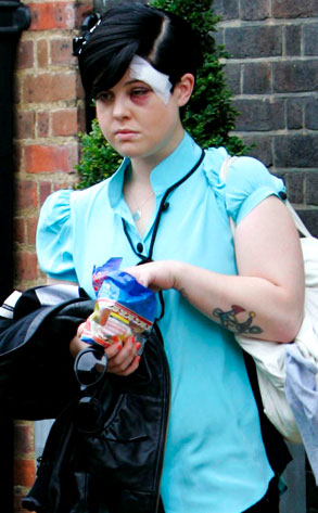 Kelly Osbourne Kelly Osbourne